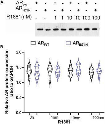 Characterization With Gene Mutations in Han Chinese Patients With Hypospadias and Function Analysis of a Novel AR Genevariant